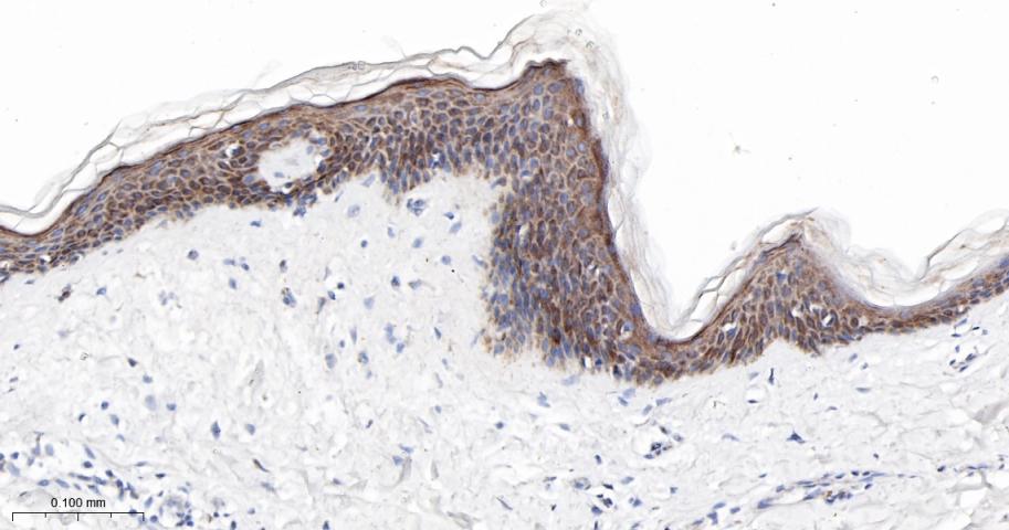 肌浆/内质网钙ATP酶2重组兔单抗-bsm-61408R