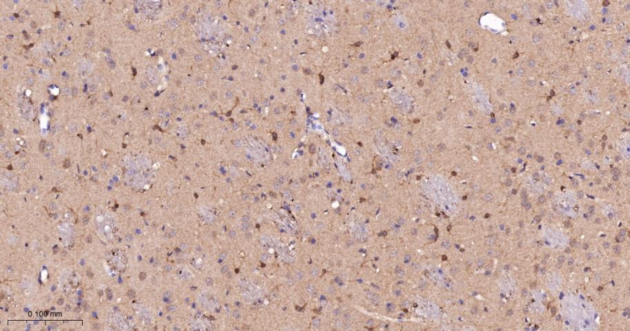 蛋白激酶C-δ/θ重组兔单抗