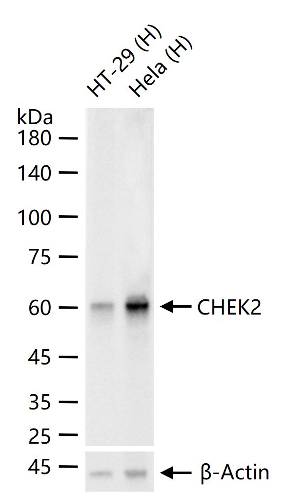 细胞周期检测点激酶2重组兔单抗