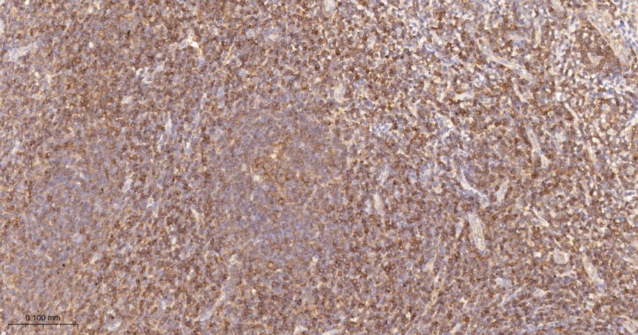 蛋白激酶C-δ/θ重组兔单抗