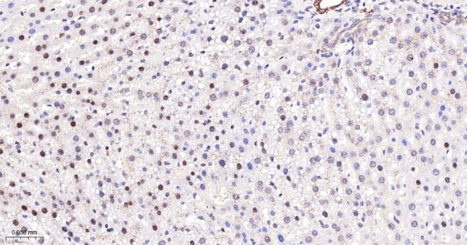 磷酸化蛋白激酶C α/β2重组兔单抗