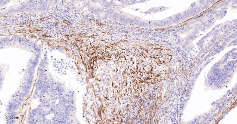 细胞骨架相关蛋白重组兔单抗