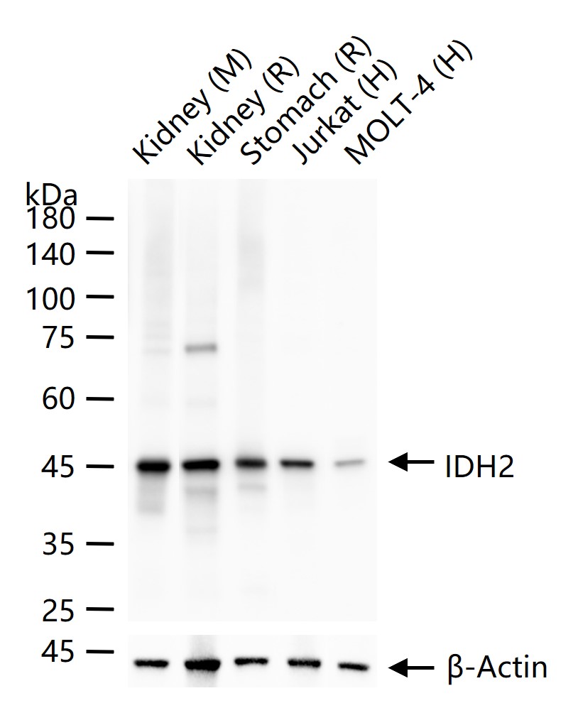 线粒体异柠檬酸脱氢酶重组兔单抗