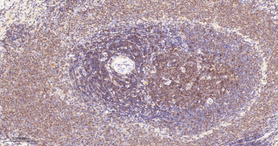 磷酸化蛋白激酶C α/β2重组兔单抗