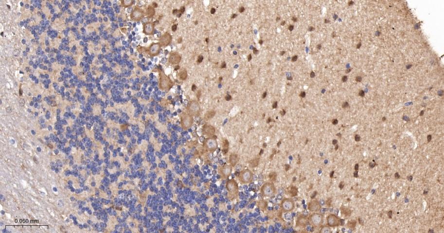 蛋白激酶C-δ/θ重组兔单抗