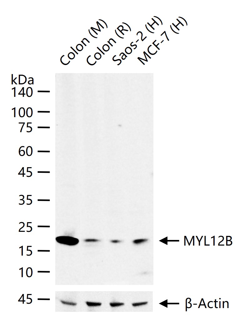 肌球蛋白调节轻链12B重组兔单抗