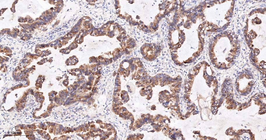 肌浆/内质网钙ATP酶2重组兔单抗-bsm-61408R
