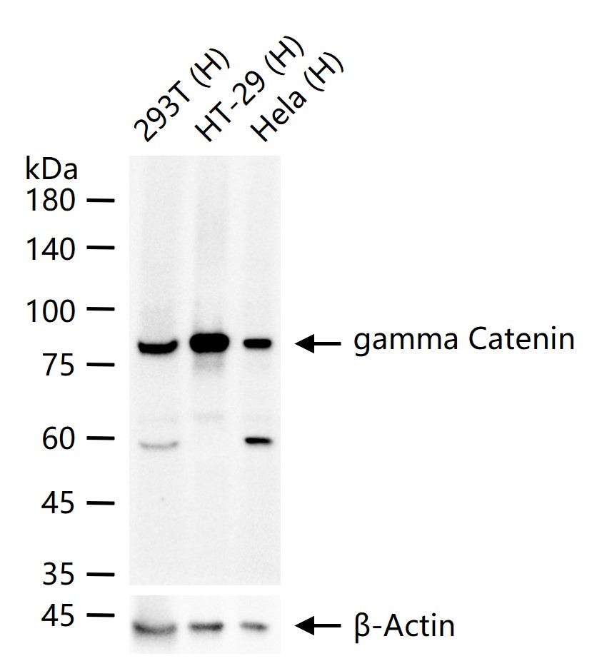 gamma Catenin Recombinant Rabbit mAb (一抗) - WB | Bioss