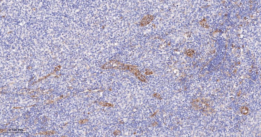 干扰素诱导跨膜蛋白3重组兔单抗