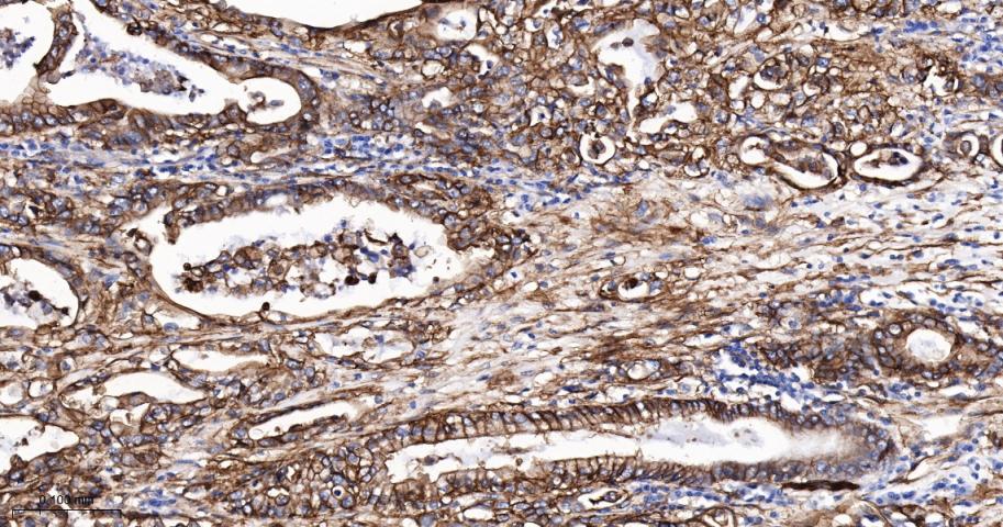 S100钙结合蛋白A10重组兔单抗