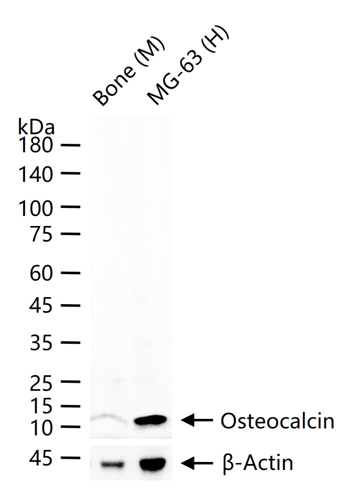 Osteocalcin Rabbit pAb (一抗) - WB,IHC-P,IHC-F,IF,ELISA | Bioss