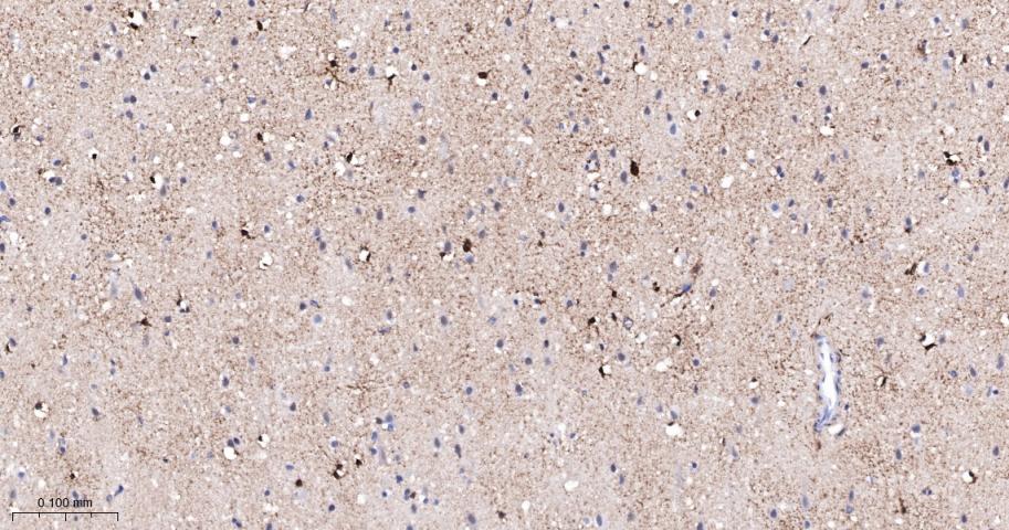 磷酸化蛋白激酶C α/β2重组兔单抗