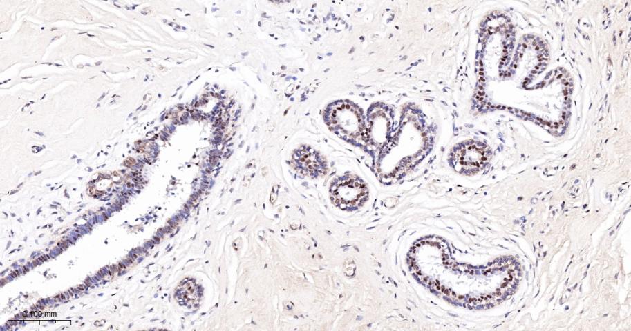 磷酸化蛋白激酶C α/β2重组兔单抗