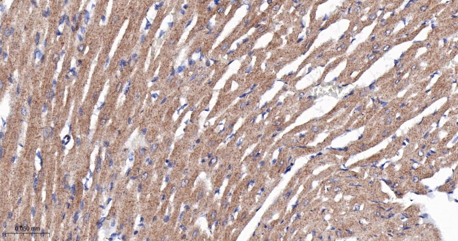 肌浆/内质网钙ATP酶2重组兔单抗-bsm-61408R
