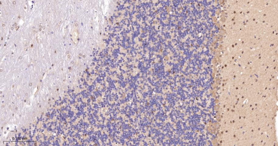 蛋白激酶C-δ/θ重组兔单抗