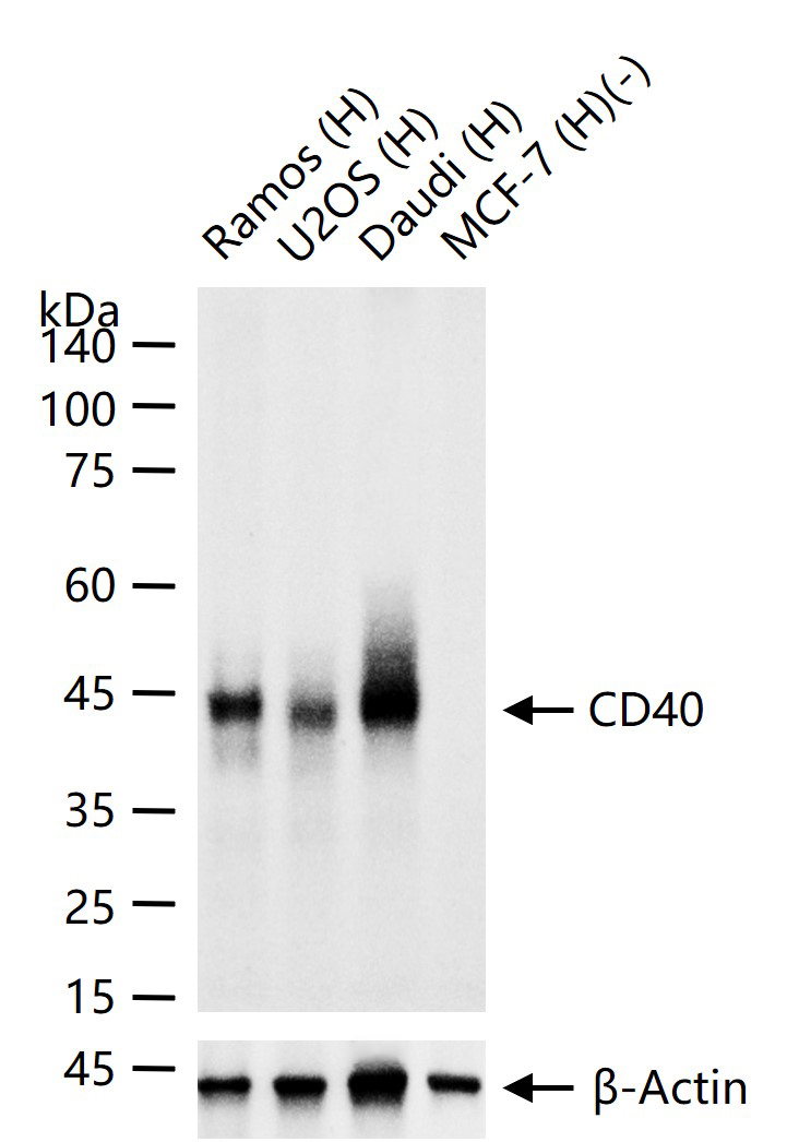 CD40 重组兔单克隆抗体
