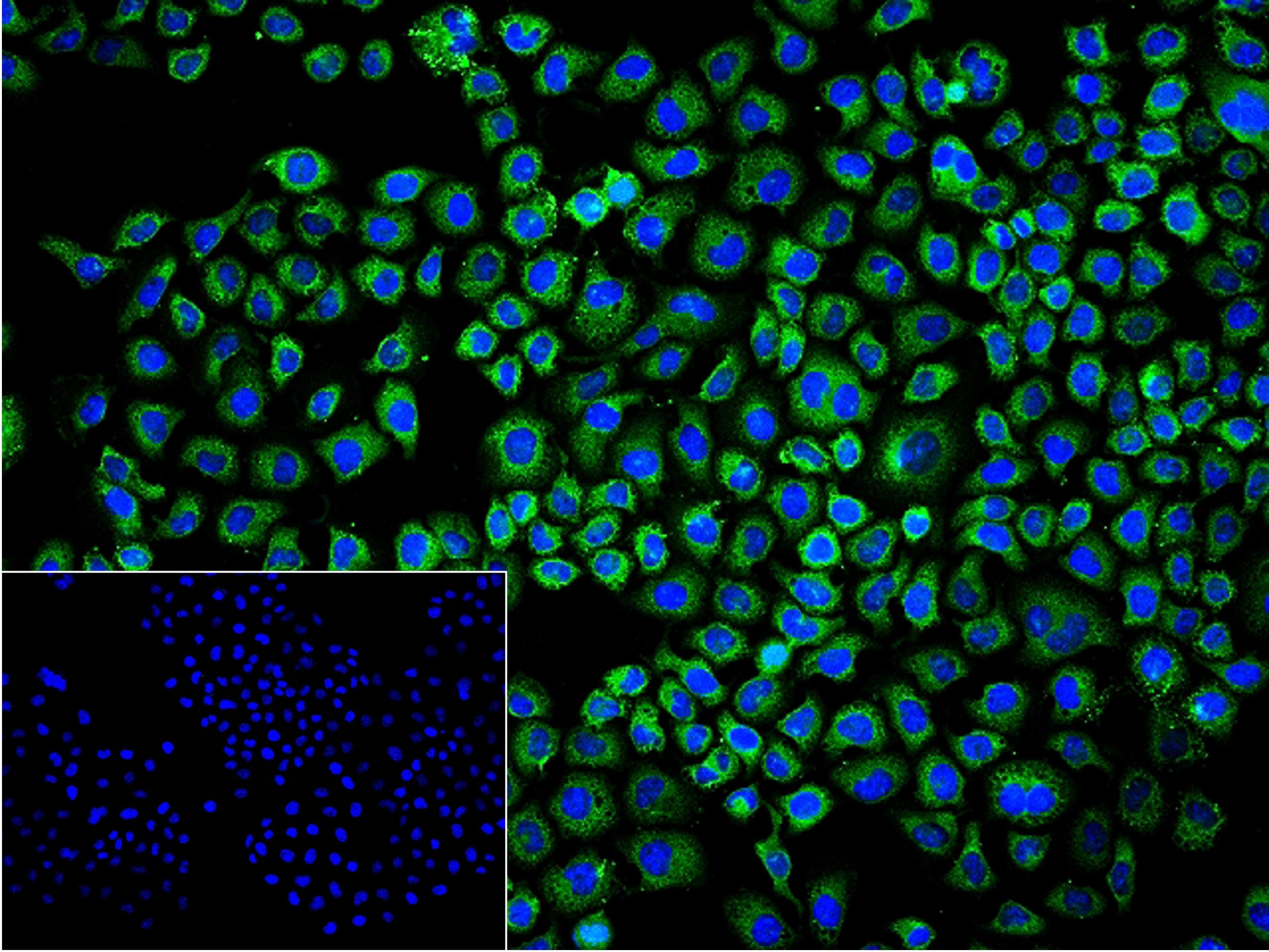 金属蛋白酶组织抑制因子-1单克隆抗体-bsm-10895M
