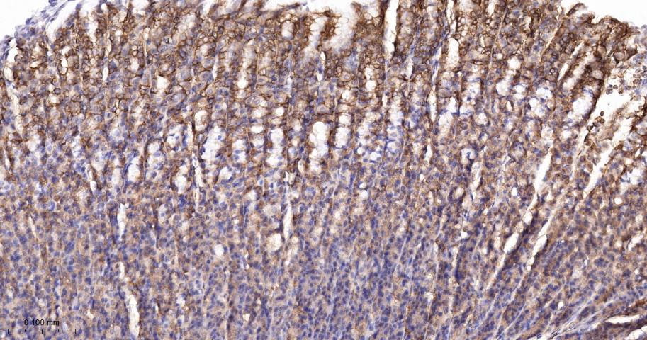 核酸酶敏感元件结合蛋白1重组兔单抗