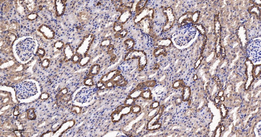 谷草转氨酶2重组兔单抗