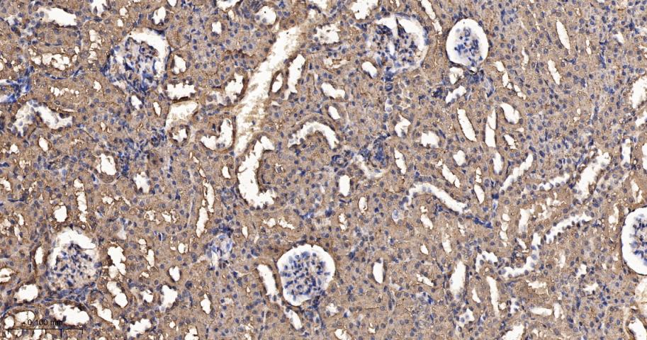 原癌基因Ras重组兔单抗