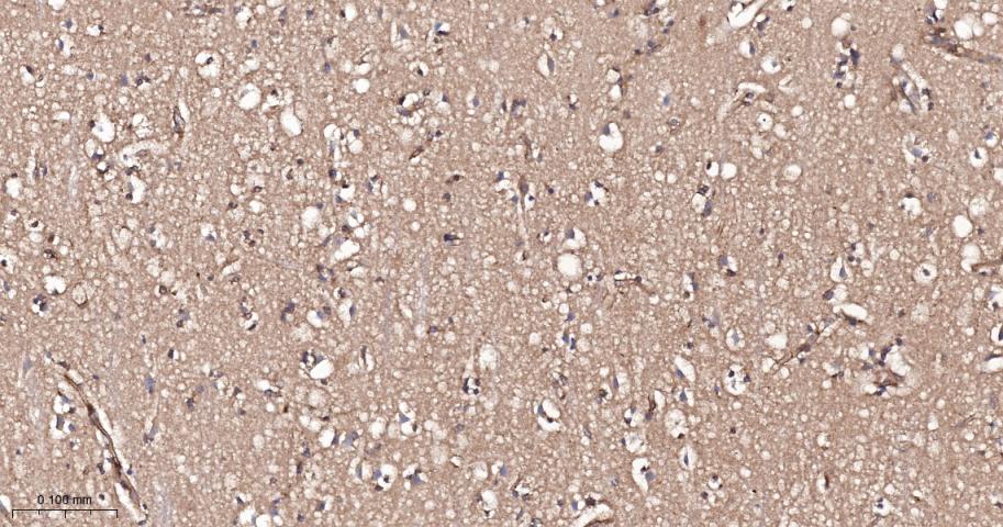 磷酯酶Cγ2重组兔单抗