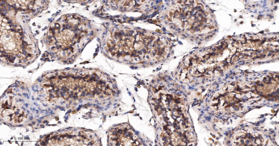 p53正向细胞凋亡调控因子重组兔单抗