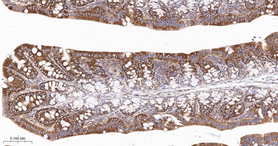 核酸酶敏感元件结合蛋白1重组兔单抗