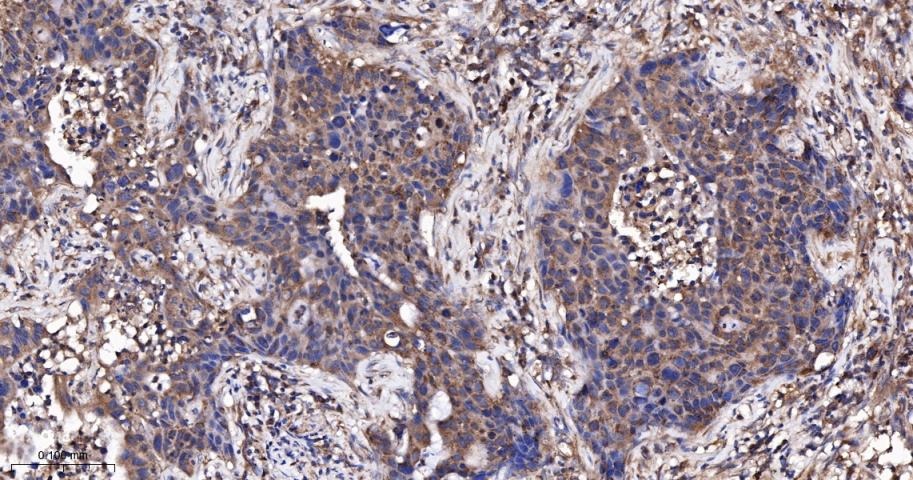 磷酯酶Cγ2重组兔单抗