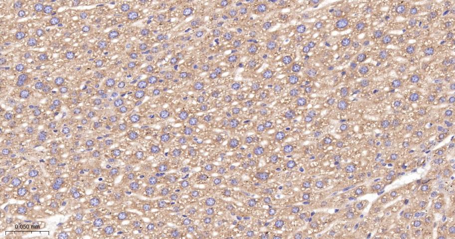 核酸酶敏感元件结合蛋白1重组兔单抗