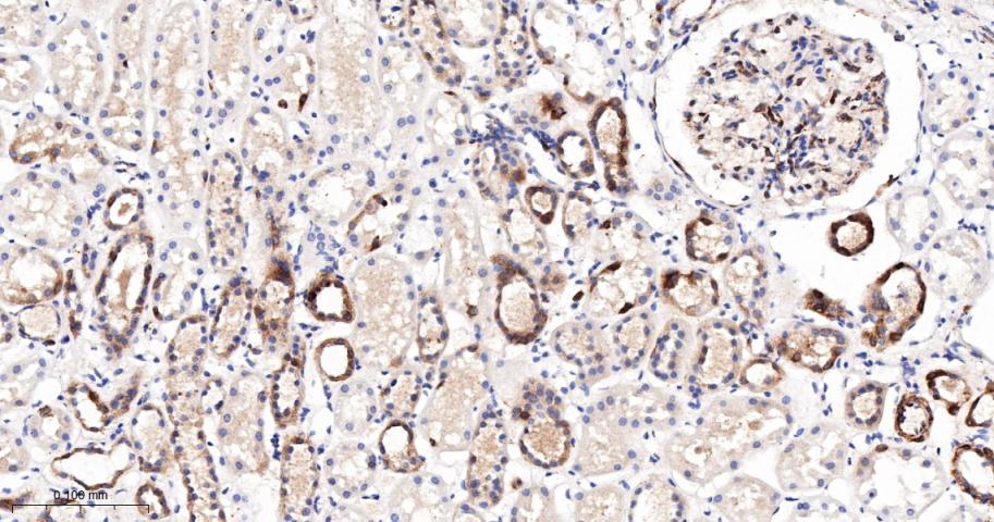核酸酶敏感元件结合蛋白1重组兔单抗