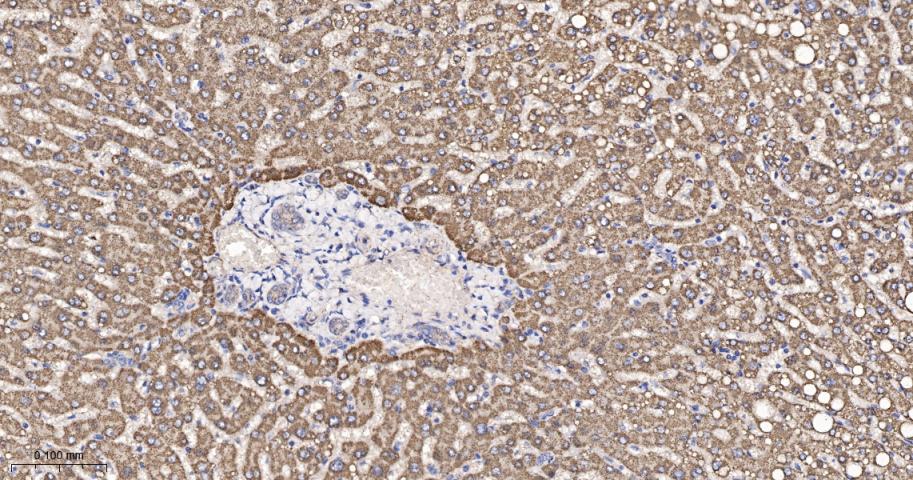 谷草转氨酶2重组兔单抗