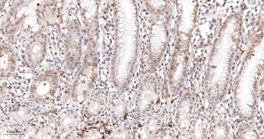 磷酸化S6核糖体蛋白重组兔单抗