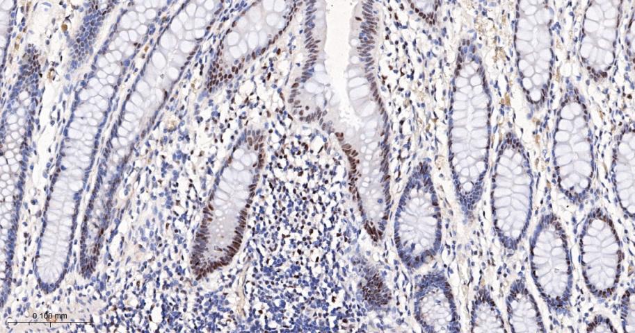 细胞周期检测点激酶2重组兔单抗