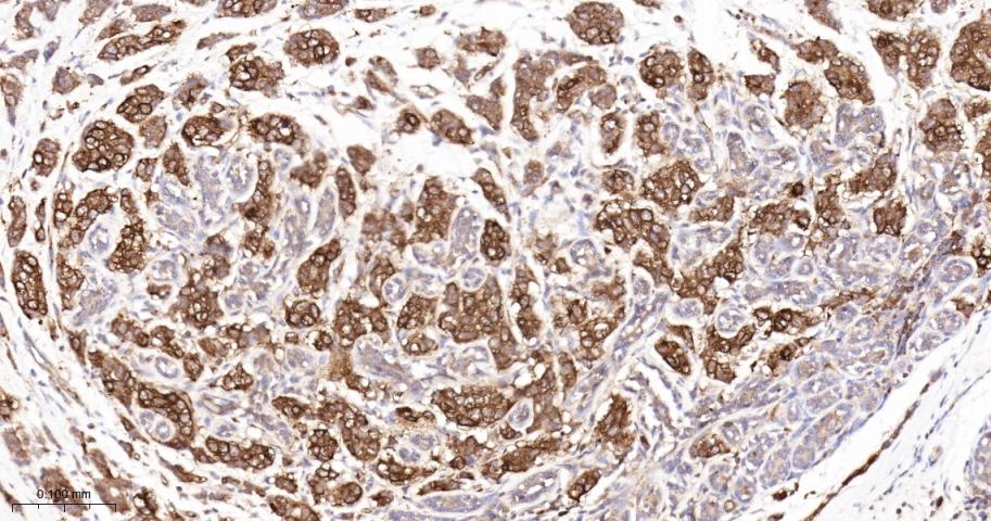 跨膜接头蛋白PAG重组兔单抗-bsm-62406R