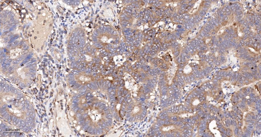 跨膜接头蛋白PAG重组兔单抗-bsm-62406R