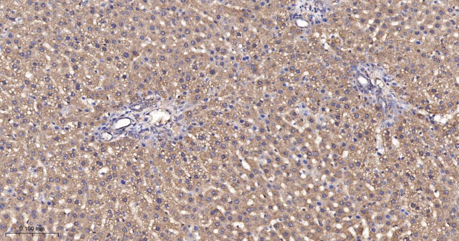 谷草转氨酶2重组兔单抗
