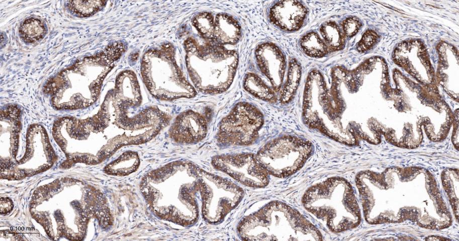 p53正向细胞凋亡调控因子重组兔单抗