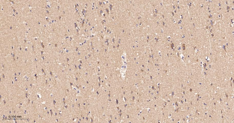 谷草转氨酶2重组兔单抗