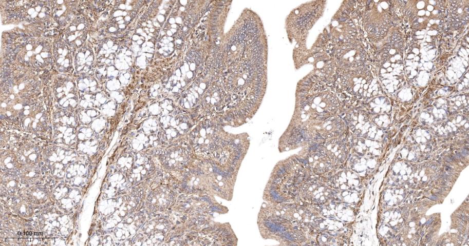 原癌基因Ras重组兔单抗