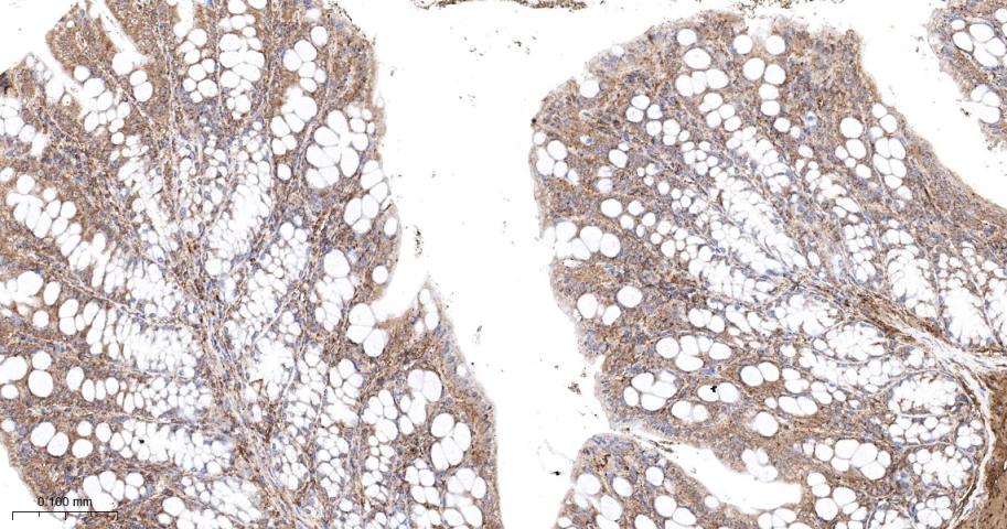原癌基因Ras重组兔单抗