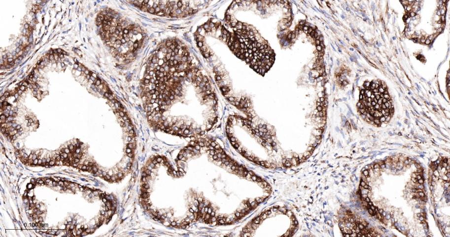 核酸酶敏感元件结合蛋白1重组兔单抗