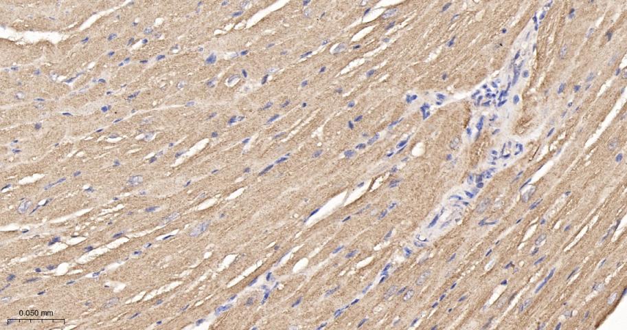 谷草转氨酶2重组兔单抗