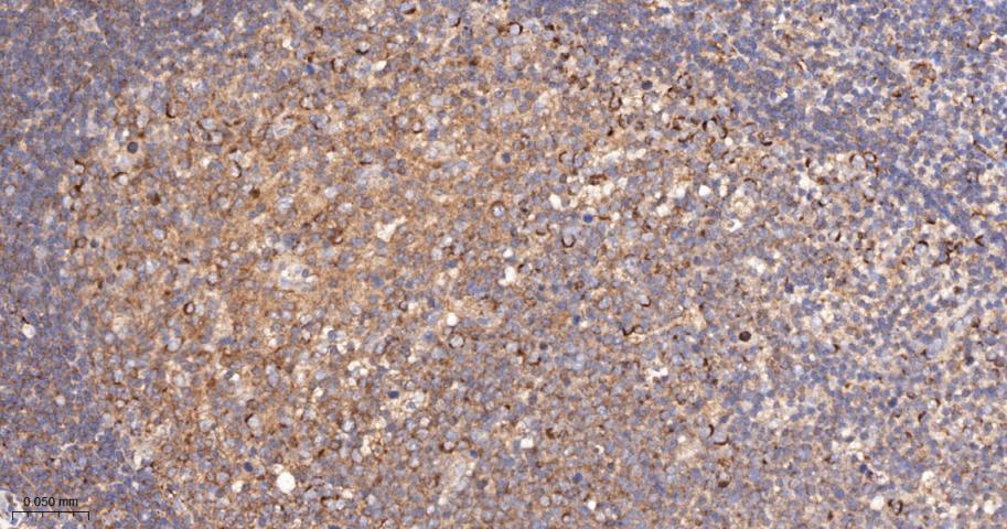 磷酯酶Cγ2重组兔单抗