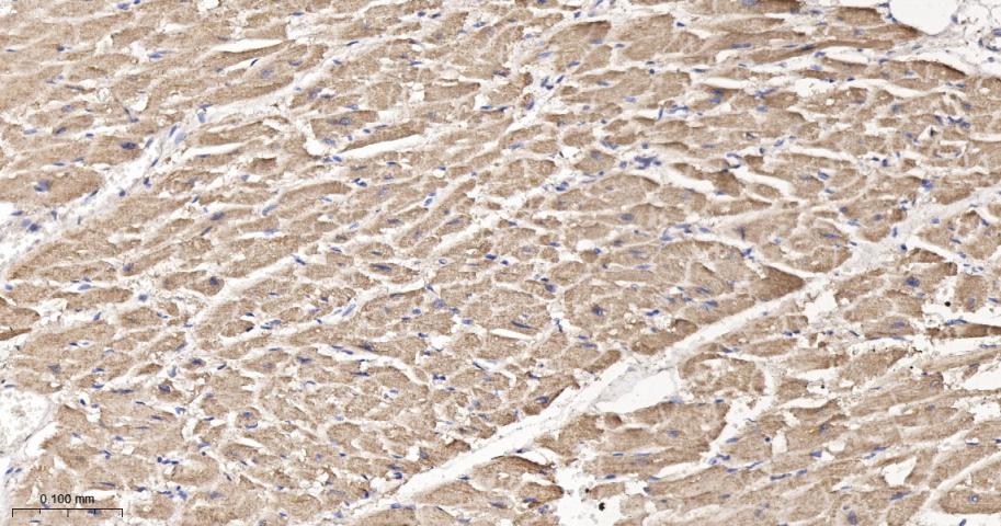 谷草转氨酶2重组兔单抗