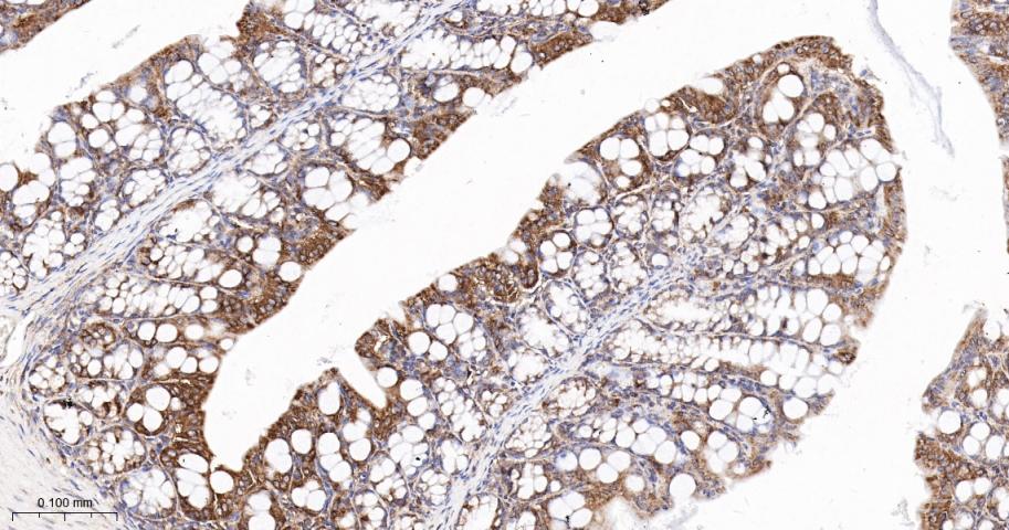 核酸酶敏感元件结合蛋白1重组兔单抗