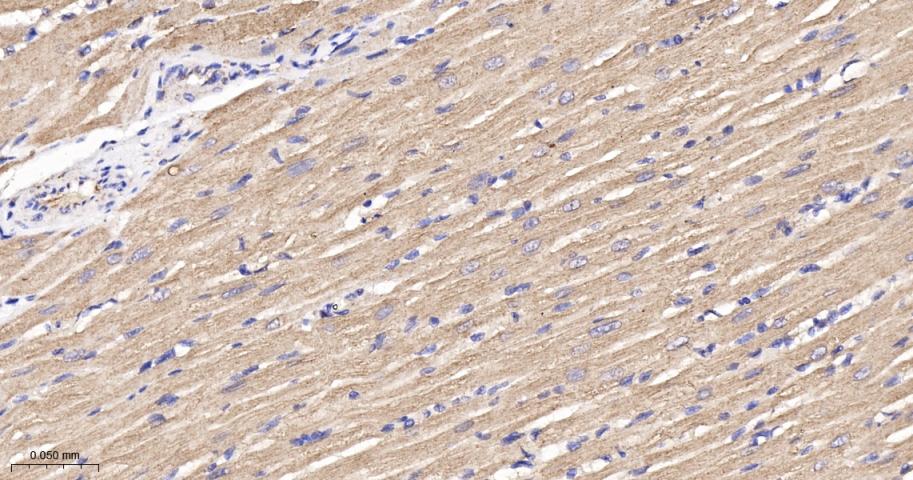 谷草转氨酶2重组兔单抗