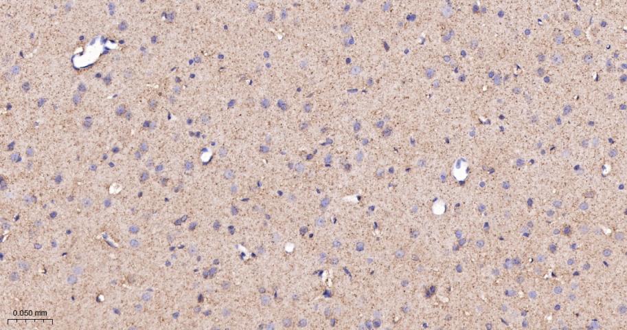 谷草转氨酶2重组兔单抗