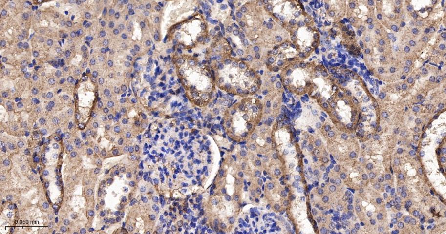 谷草转氨酶2重组兔单抗