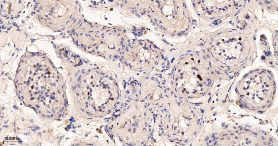 细胞周期检测点激酶2重组兔单抗