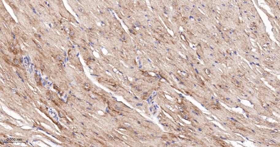 p53正向细胞凋亡调控因子重组兔单抗